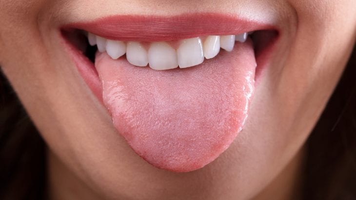 Tongue tip white of on bubble Pimples or