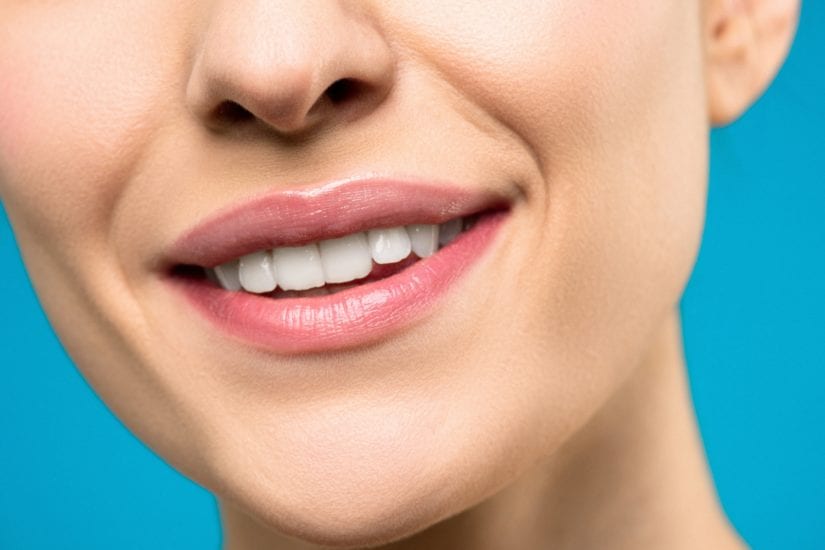 teeth whitening