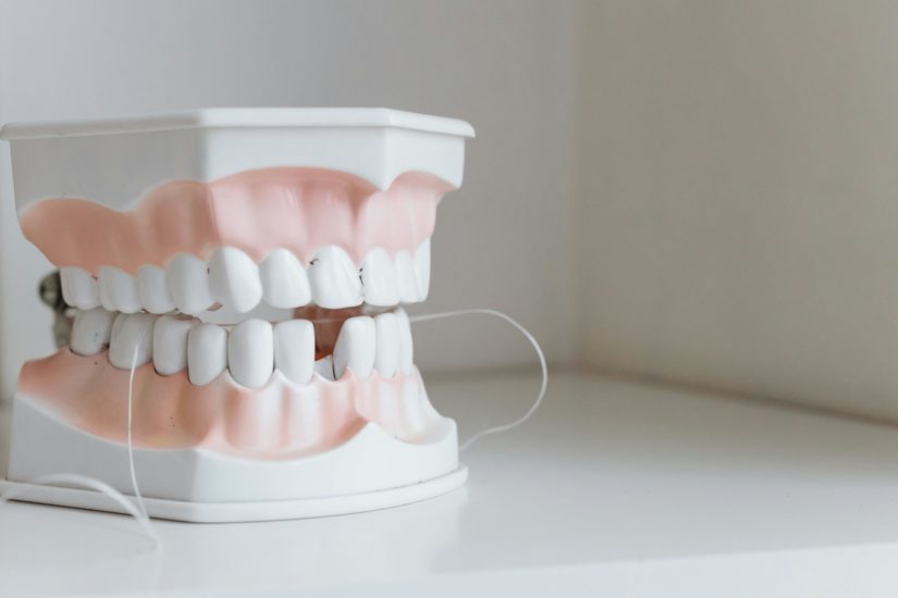 broken tooth