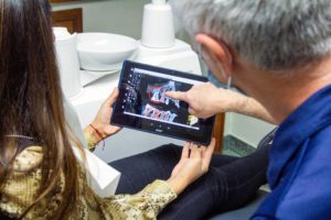 Wisdom tooth crowding