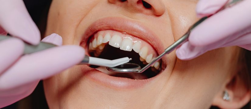 Cosmetic dentistry at Tindale Dental Centre