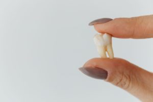 cracked tooth vs broken tooth