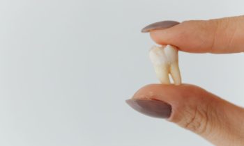 cracked tooth vs broken tooth