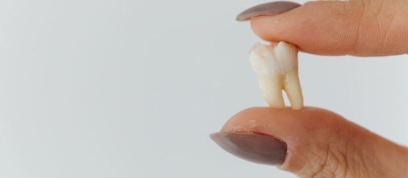 cracked tooth vs broken tooth