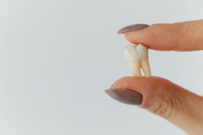 cracked tooth vs broken tooth