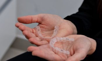 braces vs aligners
