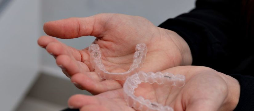 braces vs aligners