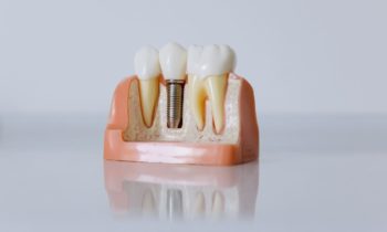 restorative dentistry