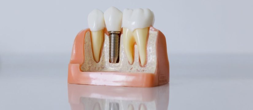 restorative dentistry
