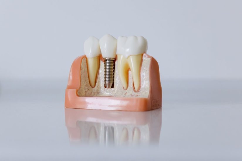 restorative dentistry